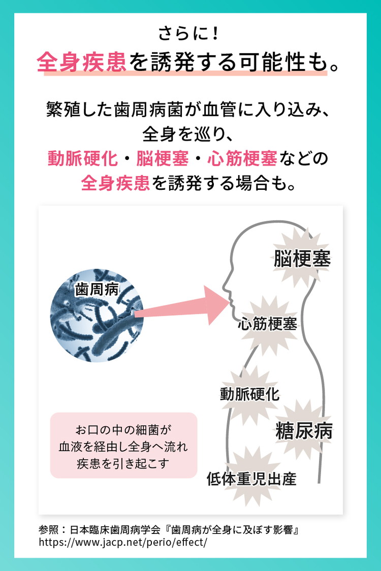 【6ヵ月定期便】歯周病ケア 歯磨き粉 ペリオテクト シトラスミックス味 ホワイトエッセンス [医薬部外品] | 定期便 6か月 IPMP CPC 歯周病 歯槽膿漏 予防 対策 研磨剤なし 黄ばみ ヤニ取り 茶渋 美白 自宅 簡単 歯科 歯医者 歯磨き 歯みがき粉 ブレスケア